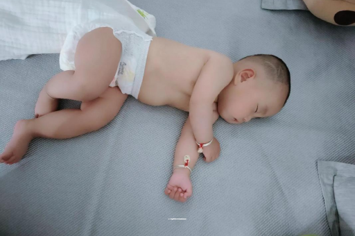 仁怀宝宝头上长痱子